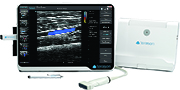 terason-uSmart-3200t-ultrasound-machine