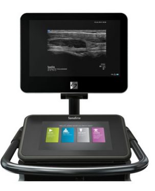 SonoSite X-Porte Ultrasound