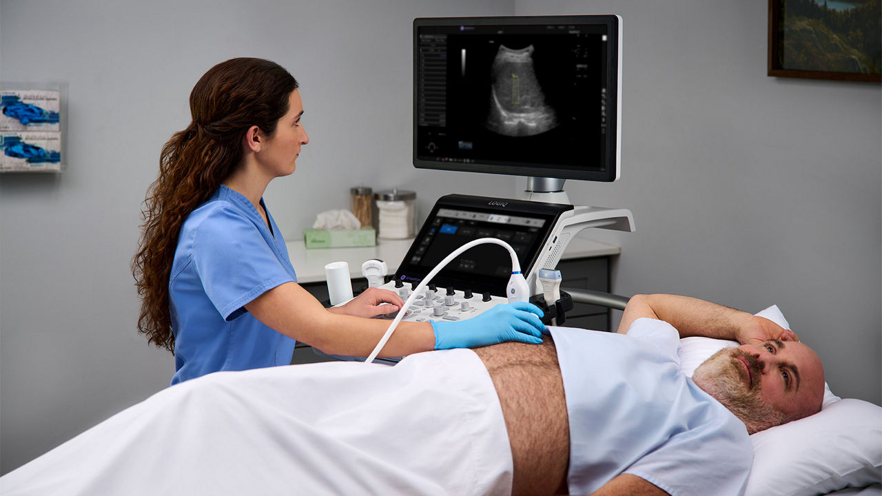 GE LOGIQ Totus cart console ultrasound system displaying high-resolution diagnostic imaging