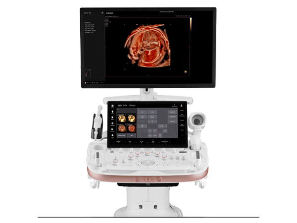Siemens ACUSON Maple mobile cart console ultrasound system displaying high-resolution diagnostic imaging