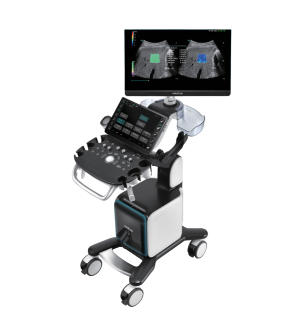 Mindray Consona n9 with clinical image on the screen as viewed from an elevated oblique angle.
