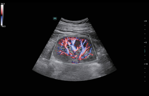 Mindray Consona N9 high-resolution color flow Doppler and vascular imaging display