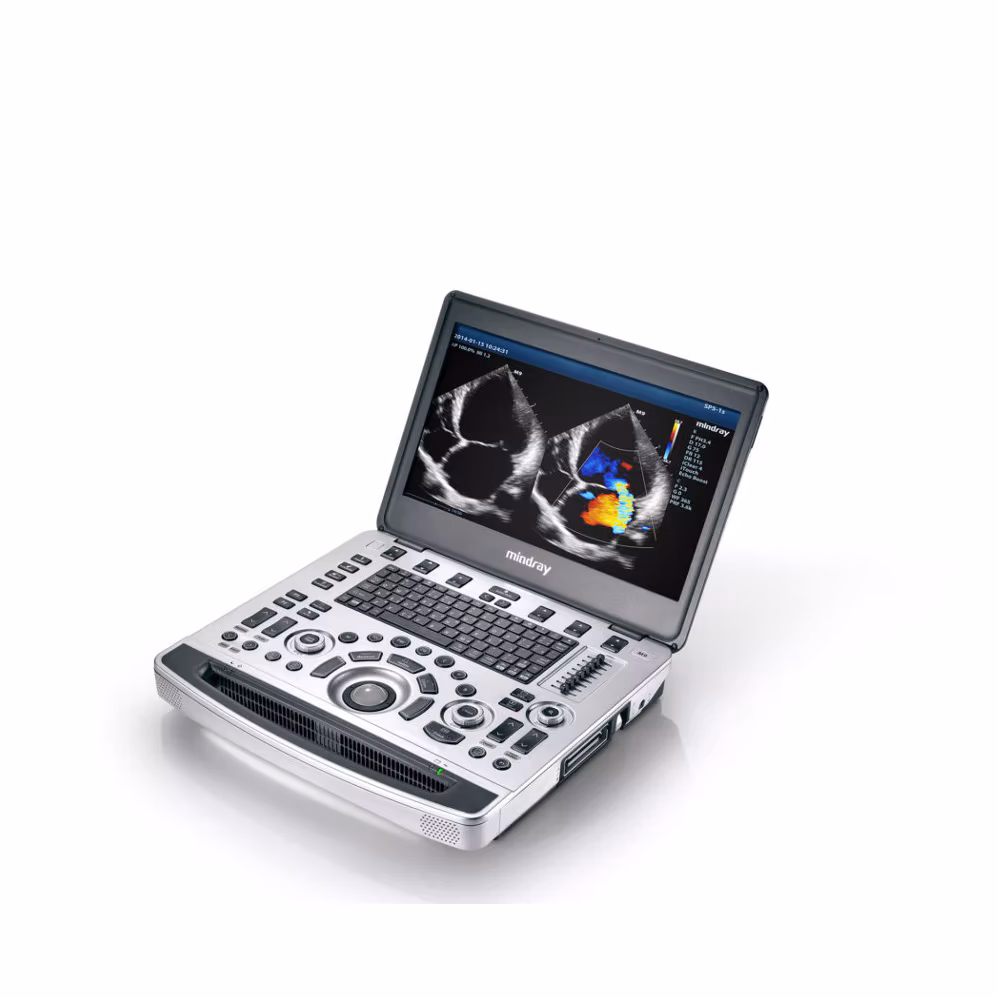 Mindray M9 portable laptop ultrasound system open on a mobile cart showing keyboard layout, active screen, and probe connections