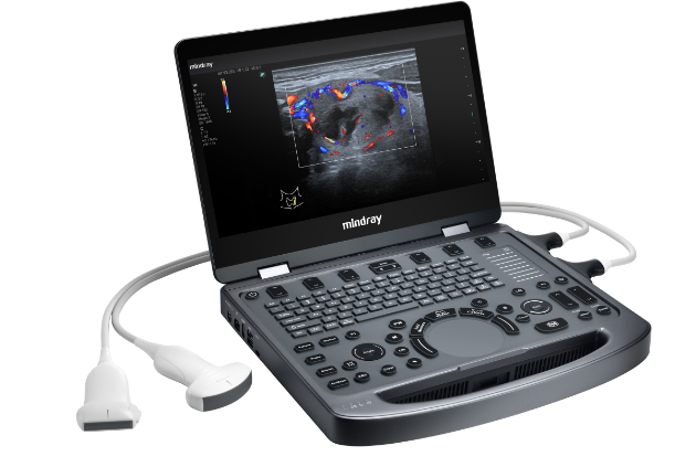 Mindray MX portable laptop ultrasound system featuring a 15.6-inch Full HD screen and sealed touchscreen