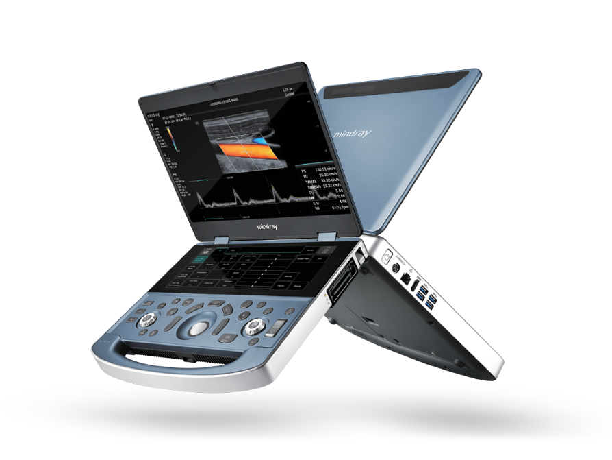 Mindray MX7 portable laptop ultrasound system displaying its 15.6-inch HD screen and sealed touchscreen